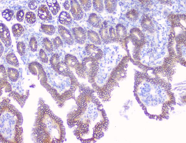 IHC analysis of CTNNB1 using anti-CTNNB1 antibody (A00004). CTNNB1 was detected in paraffin-embedded section of mouse intestine tissue. Heat mediated antigen retrieval was performed in citrate buffer (pH6, epitope retrieval solution) for 20 mins. The tissue section was blocked with 10% goat serum. The tissue section was then incubated with 1μg/ml rabbit anti-CTNNB1 Antibody (A00004) overnight at 4°C. Biotinylated goat anti-rabbit IgG was used as secondary antibody and incubated for 30 minutes at 37°C. The tissue section was developed using Strepavidin-Biotin-Complex (SABC)(Catalog # SA1022) with DAB as the chromogen.