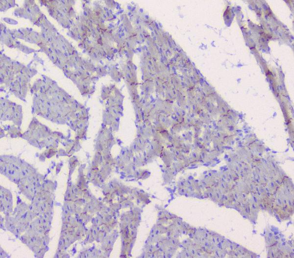 IHC analysis of CTNNB1 using anti-CTNNB1 antibody (A00004). CTNNB1 was detected in paraffin-embedded section of mouse heart tissue. Heat mediated antigen retrieval was performed in citrate buffer (pH6, epitope retrieval solution) for 20 mins. The tissue section was blocked with 10% goat serum. The tissue section was then incubated with 1μg/ml rabbit anti-CTNNB1 Antibody (A00004) overnight at 4°C. Biotinylated goat anti-rabbit IgG was used as secondary antibody and incubated for 30 minutes at 37°C. The tissue section was developed using Strepavidin-Biotin-Complex (SABC)(Catalog # SA1022) with DAB as the chromogen.