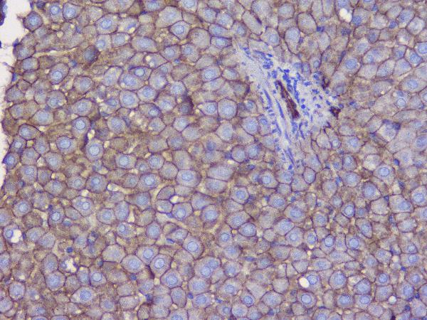 IHC analysis of CTNNB1 using anti-CTNNB1 antibody (A00004). CTNNB1 was detected in paraffin-embedded section of mouse liver tissue. Heat mediated antigen retrieval was performed in citrate buffer (pH6, epitope retrieval solution) for 20 mins. The tissue section was blocked with 10% goat serum. The tissue section was then incubated with 1μg/ml rabbit anti-CTNNB1 Antibody (A00004) overnight at 4°C. Biotinylated goat anti-rabbit IgG was used as secondary antibody and incubated for 30 minutes at 37°C. The tissue section was developed using Strepavidin-Biotin-Complex (SABC)(Catalog # SA1022) with DAB as the chromogen.