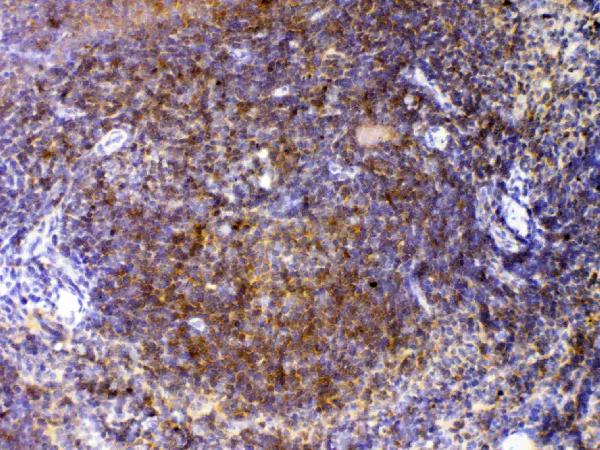 IHC analysis of CTLA4 using anti-CTLA4 antibody (A00020-1). CTLA4 was detected in paraffin-embedded section of mouse spleen tissue. Heat mediated antigen retrieval was performed in citrate buffer (pH6, epitope retrieval solution) for 20 mins. The tissue section was blocked with 10% goat serum. The tissue section was then incubated with 1μg/ml rabbit anti-CTLA4 Antibody (A00020-1) overnight at 4°C. Biotinylated goat anti-rabbit IgG was used as secondary antibody and incubated for 30 minutes at 37°C. The tissue section was developed using Strepavidin-Biotin-Complex (SABC)(Catalog # SA1022) with DAB as the chromogen.