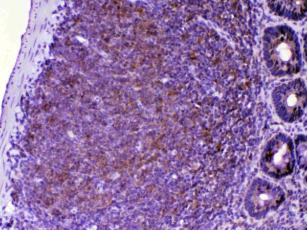 IHC analysis of CTLA4 using anti-CTLA4 antibody (A00020-1). CTLA4 was detected in paraffin-embedded section of rat lymphaden tissue. Heat mediated antigen retrieval was performed in citrate buffer (pH6, epitope retrieval solution) for 20 mins. The tissue section was blocked with 10% goat serum. The tissue section was then incubated with 1μg/ml rabbit anti-CTLA4 Antibody (A00020-1) overnight at 4°C. Biotinylated goat anti-rabbit IgG was used as secondary antibody and incubated for 30 minutes at 37°C. The tissue section was developed using Strepavidin-Biotin-Complex (SABC)(Catalog # SA1022) with DAB as the chromogen.