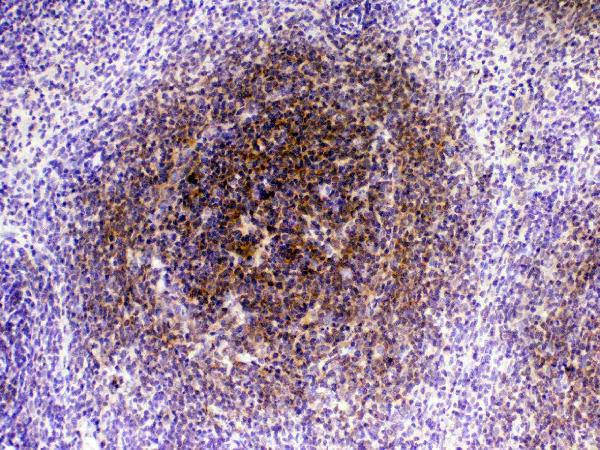 IHC analysis of CTLA4 using anti-CTLA4 antibody (A00020-1). CTLA4 was detected in paraffin-embedded section of rat spleen tissue. Heat mediated antigen retrieval was performed in citrate buffer (pH6, epitope retrieval solution) for 20 mins. The tissue section was blocked with 10% goat serum. The tissue section was then incubated with 1μg/ml rabbit anti-CTLA4 Antibody (A00020-1) overnight at 4°C. Biotinylated goat anti-rabbit IgG was used as secondary antibody and incubated for 30 minutes at 37°C. The tissue section was developed using Strepavidin-Biotin-Complex (SABC)(Catalog # SA1022) with DAB as the chromogen.