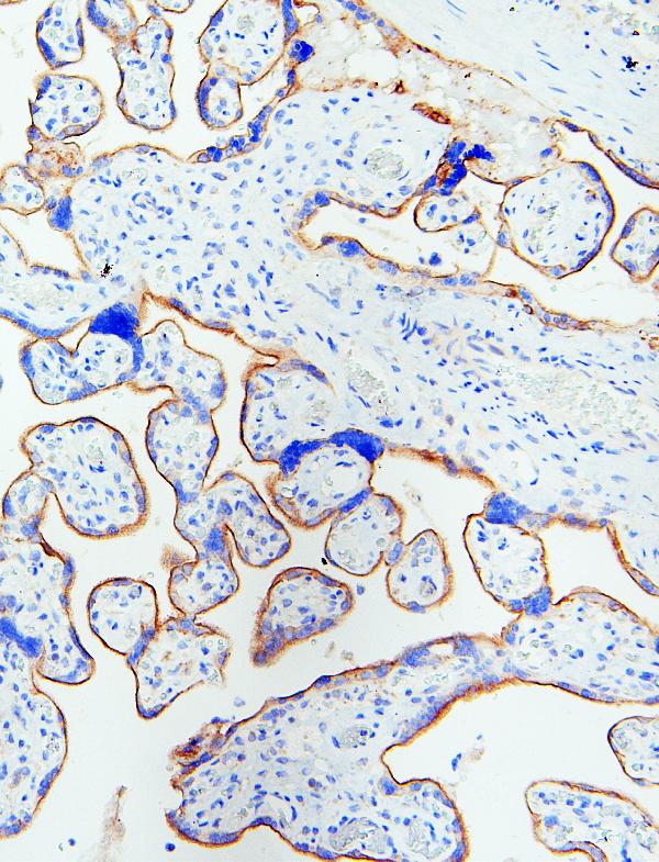 IHC analysis of EGFR using anti-EGFR antibody (A00023). EGFR was detected in paraffin-embedded section of human placenta tissues. Heat mediated antigen retrieval was performed in citrate buffer (pH6, epitope retrieval solution) for 20 mins. The tissue section was blocked with 10% goat serum. The tissue section was then incubated with 1μg/ml rabbit anti-EGFR Antibody (A00023) overnight at 4°C. Biotinylated goat anti-rabbit IgG was used as secondary antibody and incubated for 30 minutes at 37°C. The tissue section was developed using Strepavidin-Biotin-Complex (SABC)(Catalog # SA1022) with DAB as the chromogen.