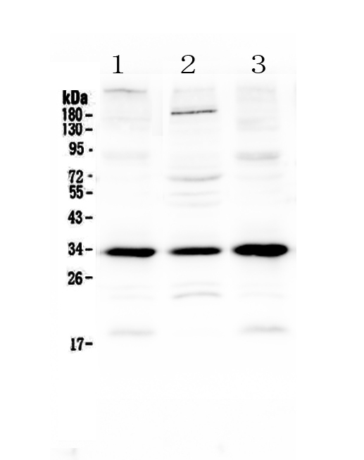 Western blot analysis of MyD88 using anti-MyD88 antibody (A00025-1). Electrophoresis was performed on a 5-20% SDS-PAGE gel at 70V (Stacking gel) / 90V (Resolving gel) for 2-3 hours. The sample well of each lane was loaded with 50ug of sample under reducing conditions. Lane 1: mouse spleen tissue lysates, Lane 2: mouse testis tissue lysates, Lane 3: rat spleen tissue lysates. After Electrophoresis, proteins were transferred to a Nitrocellulose membrane at 150mA for 50-90 minutes. Blocked the membrane with 5% Non-fat Milk/ TBS for 1.5 hour at RT. The membrane was incubated with rabbit anti-MyD88 antigen affinity purified polyclonal antibody (Catalog # A00025-1) at 0.5 ug/mL overnight at 4 then washed with TBS-0.1%Tween 3 times with 5 minutes each and probed with a goat anti-rabbit IgG-HRP secondary antibody at a dilution of 1:10000 for 1.5 hour at RT. The signal is developed using an Enhanced Chemiluminescent detection (ECL) kit (Catalog # EK1002) with Tanon 5200 system. A specific band was detected for MyD88 at approximately 33KD. The expected band size for MyD88 is at 33KD.