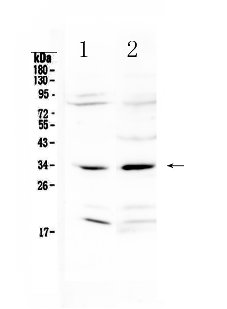 Western blot analysis of MyD88 using anti-MyD88 antibody (A00025-2). Electrophoresis was performed on a 5-20% SDS-PAGE gel at 70V (Stacking gel) / 90V (Resolving gel) for 2-3 hours. The sample well of each lane was loaded with 50ug of sample under reducing conditions. Lane 1: rat liver tissue lysates, Lane 2: rat ovary tissue lysates. After Electrophoresis, proteins were transferred to a Nitrocellulose membrane at 150mA for 50-90 minutes. Blocked the membrane with 5% Non-fat Milk/ TBS for 1.5 hour at RT. The membrane was incubated with rabbit anti-MyD88 antigen affinity purified polyclonal antibody (Catalog # A00025-2) at 0.5 ug/mL overnight at 4 then washed with TBS-0.1%Tween 3 times with 5 minutes each and probed with a goat anti-rabbit IgG-HRP secondary antibody at a dilution of 1:10000 for 1.5 hour at RT. The signal is developed using an Enhanced Chemiluminescent detection (ECL) kit (Catalog # EK1002) with Tanon 5200 system. A specific band was detected for MyD88 at approximately 33KD. The expected band size for MyD88 is at 33KD.