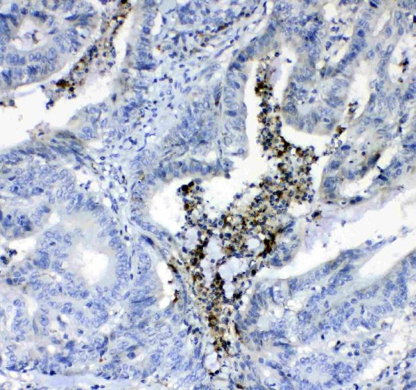 IHC analysis of Prothrombin using anti-Prothrombin antibody (A00044).