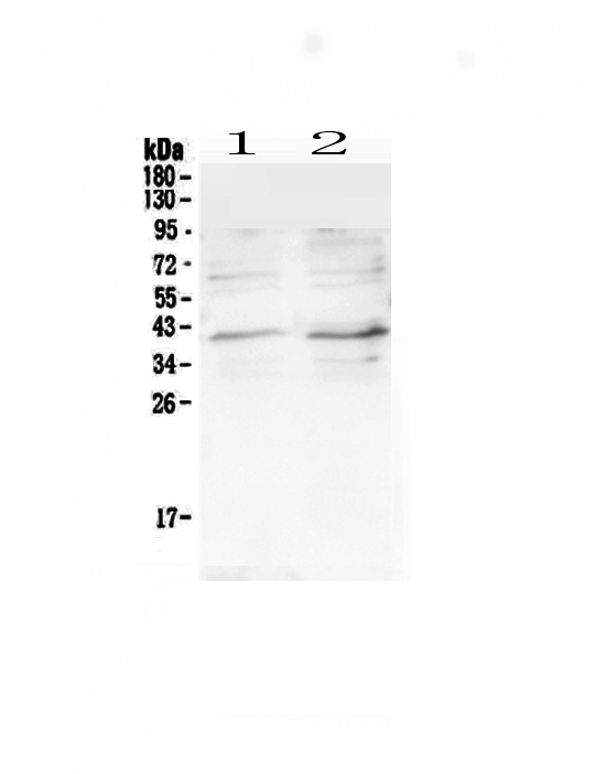 Western blot analysis of CCR5 using anti-CCR5 antibody (A00061).