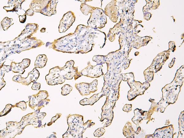 IHC analysis of HP using anti-HP antibody (A00062-1). HP was detected in paraffin-embedded section of human placenta tissue. Heat mediated antigen retrieval was performed in citrate buffer (pH6, epitope retrieval solution) for 20 mins. The tissue section was blocked with 10% goat serum. The tissue section was then incubated with 1μg/ml rabbit anti-HP Antibody (A00062-1) overnight at 4°C. Biotinylated goat anti-rabbit IgG was used as secondary antibody and incubated for 30 minutes at 37°C. The tissue section was developed using Strepavidin-Biotin-Complex (SABC)(Catalog # SA1022) with DAB as the chromogen.