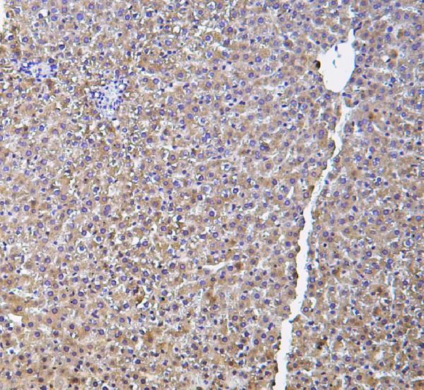 IHC analysis of HP using anti-HP antibody (A00062-1).