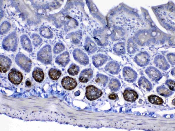 IHC analysis of IGF1 Receptor using anti-IGF1 Receptor antibody (A00070). IGF1 Receptor was detected in paraffin-embedded section of mouse small intestine tissue. Heat mediated antigen retrieval was performed in citrate buffer (pH6, epitope retrieval solution) for 20 mins. The tissue section was blocked with 10% goat serum. The tissue section was then incubated with 1ug/ml rabbit anti-IGF1 Receptor Antibody (A00070) overnight at 4 Biotinylated goat anti-rabbit IgG was used as secondary antibody and incubated for 30 minutes at 37 The tissue section was developed using Strepavidin-Biotin-Complex (SABC)(Catalog # SA1022) with DAB as the chromogen.