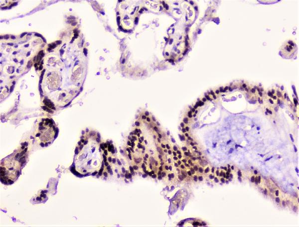 IHC analysis of Rad51 using anti-Rad51 antibody (A00088). Rad51 was detected in paraffin-embedded section of human placenta tissue. Heat mediated antigen retrieval was performed in citrate buffer (pH6, epitope retrieval solution) for 20 mins. The tissue section was blocked with 10% goat serum. The tissue section was then incubated with 1μg/ml rabbit anti-Rad51 Antibody (A00088) overnight at 4°C. Biotinylated goat anti-rabbit IgG was used as secondary antibody and incubated for 30 minutes at 37°C. The tissue section was developed using Strepavidin-Biotin-Complex (SABC)(Catalog # SA1022) with DAB as the chromogen.