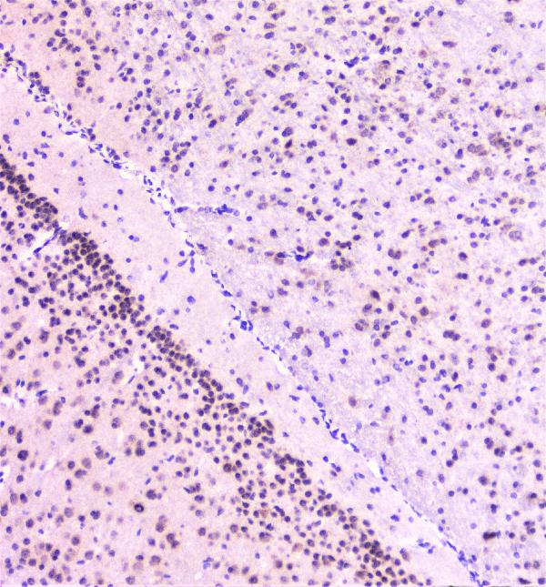 IHC analysis of Rad51 using anti-Rad51 antibody (A00088). Rad51 was detected in paraffin-embedded section of mouse brain tissue. Heat mediated antigen retrieval was performed in citrate buffer (pH6, epitope retrieval solution) for 20 mins. The tissue section was blocked with 10% goat serum. The tissue section was then incubated with 1μg/ml rabbit anti-Rad51 Antibody (A00088) overnight at 4°C. Biotinylated goat anti-rabbit IgG was used as secondary antibody and incubated for 30 minutes at 37°C. The tissue section was developed using Strepavidin-Biotin-Complex (SABC)(Catalog # SA1022) with DAB as the chromogen.