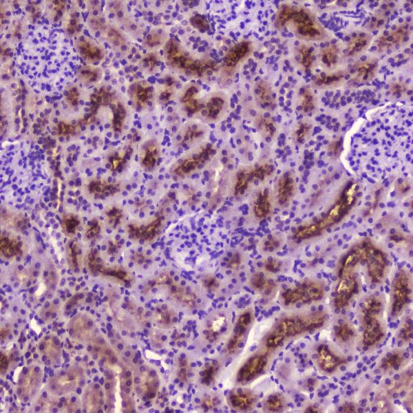 IHC analysis of PDGFRB using anti-PDGFRB antibody (A00096-1). PDGFRB was detected in paraffin-embedded section of rat kidney tissue. Heat mediated antigen retrieval was performed in citrate buffer (pH6, epitope retrieval solution) for 20 mins. The tissue section was blocked with 10% goat serum. The tissue section was then incubated with 2μg/ml rabbit anti-PDGFRB Antibody (A00096-1) overnight at 4℃. Biotinylated goat anti-rabbit IgG was used as secondary antibody and incubated for 30 minutes at 37℃. The tissue section was developed using Strepavidin-Biotin-Complex (SABC)(Catalog # SA1022) with DAB as the chromogen.