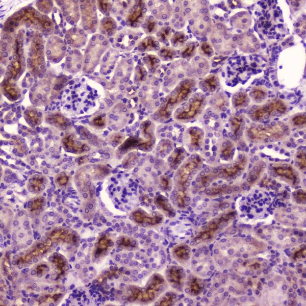 IHC analysis of PDGFRB using anti-PDGFRB antibody (A00096-1). PDGFRB was detected in paraffin-embedded section of mouse kidney tissue. Heat mediated antigen retrieval was performed in citrate buffer (pH6, epitope retrieval solution) for 20 mins. The tissue section was blocked with 10% goat serum. The tissue section was then incubated with 2μg/ml rabbit anti-PDGFRB Antibody (A00096-1) overnight at 4°C. Biotinylated goat anti-rabbit IgG was used as secondary antibody and incubated for 30 minutes at 37°C. The tissue section was developed using Strepavidin-Biotin-Complex (SABC)(Catalog # SA1022) with DAB as the chromogen.