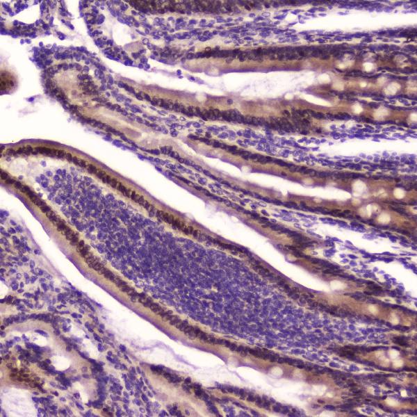 IHC analysis of KLF4 using anti-KLF4 antibody (A00120). KLF4 was detected in paraffin-embedded section of rat small intestine tissue. Heat mediated antigen retrieval was performed in citrate buffer (pH6, epitope retrieval solution) for 20 mins. The tissue section was blocked with 10% goat serum. The tissue section was then incubated with 2μg/ml rabbit anti-KLF4 Antibody (A00120) overnight at 4℃. Biotinylated goat anti-rabbit IgG was used as secondary antibody and incubated for 30 minutes at 37℃. The tissue section was developed using Strepavidin-Biotin-Complex (SABC)(Catalog # SA1022) with DAB as the chromogen.