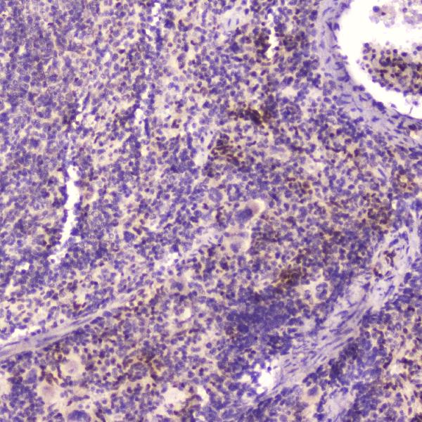 IHC analysis of KLF4 using anti-KLF4 antibody (A00120). KLF4 was detected in paraffin-embedded section of mouse spleen tissue. Heat mediated antigen retrieval was performed in citrate buffer (pH6, epitope retrieval solution) for 20 mins. The tissue section was blocked with 10% goat serum. The tissue section was then incubated with 2μg/ml rabbit anti-KLF4 Antibody (A00120) overnight at 4℃. Biotinylated goat anti-rabbit IgG was used as secondary antibody and incubated for 30 minutes at 37℃. The tissue section was developed using Strepavidin-Biotin-Complex (SABC)(Catalog # SA1022) with DAB as the chromogen.