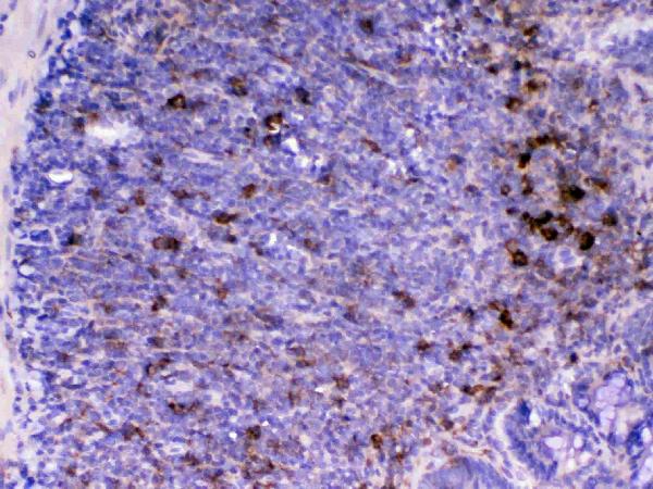 IHC analysis of CD14 using anti-CD14 antibody (A00137). CD14 was detected in paraffin-embedded section of rat lymphaden tissue. Heat mediated antigen retrieval was performed in citrate buffer (pH6, epitope retrieval solution) for 20 mins. The tissue section was blocked with 10% goat serum. The tissue section was then incubated with 1ug/ml rabbit anti-CD14 Antibody (A00137) overnight at 4 Biotinylated goat anti-rabbit IgG was used as secondary antibody and incubated for 30 minutes at 37 The tissue section was developed using Strepavidin-Biotin-Complex (SABC)(Catalog # SA1022) with DAB as the chromogen.