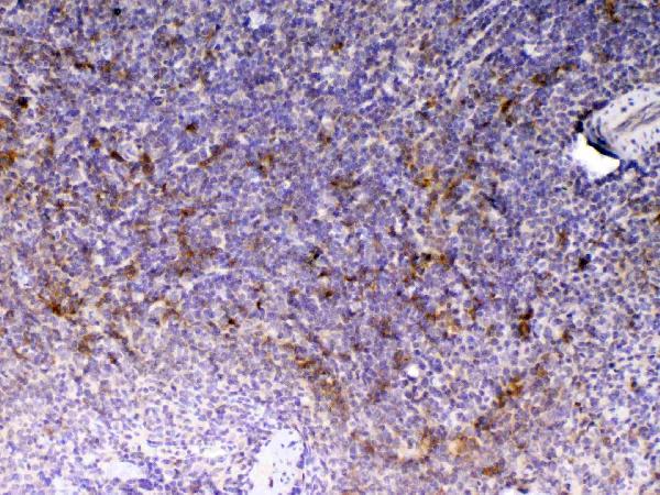 IHC analysis of CD14 using anti-CD14 antibody (A00137). CD14 was detected in paraffin-embedded section of rat spleen tissue. Heat mediated antigen retrieval was performed in citrate buffer (pH6, epitope retrieval solution) for 20 mins. The tissue section was blocked with 10% goat serum. The tissue section was then incubated with 1ug/ml rabbit anti-CD14 Antibody (A00137) overnight at 4 Biotinylated goat anti-rabbit IgG was used as secondary antibody and incubated for 30 minutes at 37 The tissue section was developed using Strepavidin-Biotin-Complex (SABC)(Catalog # SA1022) with DAB as the chromogen.