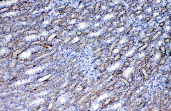 IHC analysis of Flt3 / CD135 using anti-Flt3 / CD135 antibody (A00188-4). Flt3 / CD135 was detected in paraffin-embedded section of rat kidney tissue. Heat mediated antigen retrieval was performed in citrate buffer (pH6, epitope retrieval solution) for 20 mins. The tissue section was blocked with 10% goat serum. The tissue section was then incubated with 1ug/ml rabbit anti-Flt3 / CD135 Antibody (A00188-4) overnight at 4 Biotinylated goat anti-rabbit IgG was used as secondary antibody and incubated for 30 minutes at 37 The tissue section was developed using Strepavidin-Biotin-Complex (SABC)(Catalog # SA1022) with DAB as the chromogen.