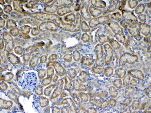 IHC analysis of Flt3 / CD135 using anti-Flt3 / CD135 antibody (A00188-4). Flt3 / CD135 was detected in paraffin-embedded section of mouse kidney tissue. Heat mediated antigen retrieval was performed in citrate buffer (pH6, epitope retrieval solution) for 20 mins. The tissue section was blocked with 10% goat serum. The tissue section was then incubated with 1ug/ml rabbit anti-Flt3 / CD135 Antibody (A00188-4) overnight at 4 Biotinylated goat anti-rabbit IgG was used as secondary antibody and incubated for 30 minutes at 37 The tissue section was developed using Strepavidin-Biotin-Complex (SABC)(Catalog # SA1022) with DAB as the chromogen.