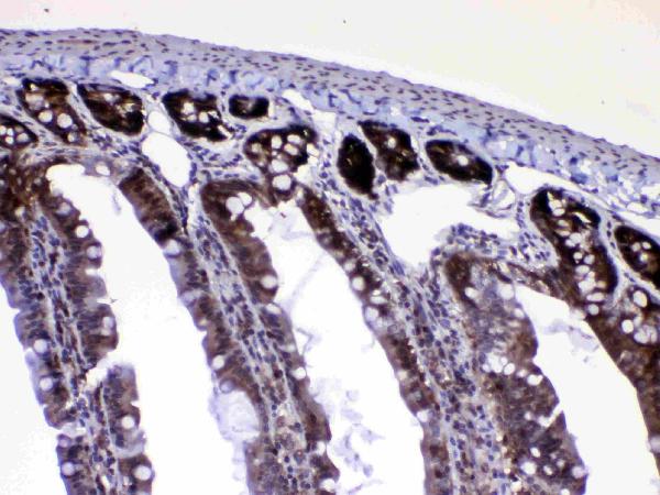 IHC analysis of Ran using anti-Ran antibody (A00204-1). Ran was detected in paraffin-embedded section of rat small intestine tissue. Heat mediated antigen retrieval was performed in citrate buffer (pH6, epitope retrieval solution) for 20 mins. The tissue section was blocked with 10% goat serum. The tissue section was then incubated with 1μg/ml rabbit anti-Ran Antibody (A00204-1) overnight at 4°C. Biotinylated goat anti-rabbit IgG was used as secondary antibody and incubated for 30 minutes at 37°C. The tissue section was developed using Strepavidin-Biotin-Complex (SABC)(Catalog # SA1022) with DAB as the chromogen.