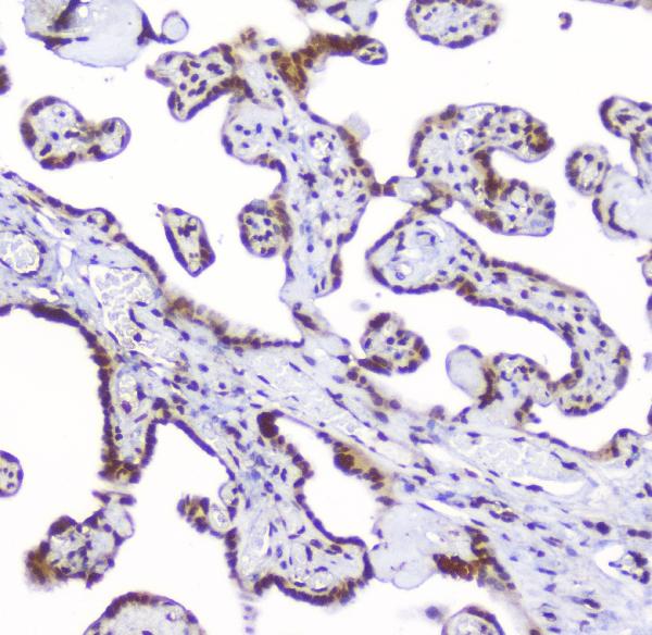 IHC analysis of AHR using anti-AHR antibody (A00225-2). AHR was detected in paraffin-embedded section of human placenta tissue. Heat mediated antigen retrieval was performed in citrate buffer (pH6, epitope retrieval solution) for 20 mins. The tissue section was blocked with 10% goat serum. The tissue section was then incubated with 2μg/ml rabbit anti-AHR Antibody (A00225-2) overnight at 4°C. Biotinylated goat anti-rabbit IgG was used as secondary antibody and incubated for 30 minutes at 37°C. The tissue section was developed using Strepavidin-Biotin-Complex (SABC)(Catalog # SA1022) with DAB as the chromogen.