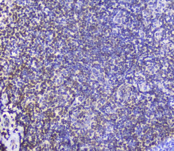 IHC analysis of AHR using anti-AHR antibody (A00225-2). AHR was detected in paraffin-embedded section of human tonsil tissue. Heat mediated antigen retrieval was performed in citrate buffer (pH6, epitope retrieval solution) for 20 mins. The tissue section was blocked with 10% goat serum. The tissue section was then incubated with 2μg/ml rabbit anti-AHR Antibody (A00225-2) overnight at 4°C. Biotinylated goat anti-rabbit IgG was used as secondary antibody and incubated for 30 minutes at 37°C. The tissue section was developed using Strepavidin-Biotin-Complex (SABC)(Catalog # SA1022) with DAB as the chromogen.