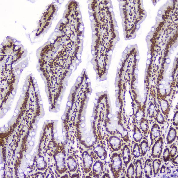 IHC analysis of AHR using anti-AHR antibody (A00225-2). AHR was detected in paraffin-embedded section of rat small intestine tissue. Heat mediated antigen retrieval was performed in citrate buffer (pH6, epitope retrieval solution) for 20 mins. The tissue section was blocked with 10% goat serum. The tissue section was then incubated with 2μg/ml rabbit anti-AHR Antibody (A00225-2) overnight at 4°C. Biotinylated goat anti-rabbit IgG was used as secondary antibody and incubated for 30 minutes at 37°C. The tissue section was developed using Strepavidin-Biotin-Complex (SABC)(Catalog # SA1022) with DAB as the chromogen.