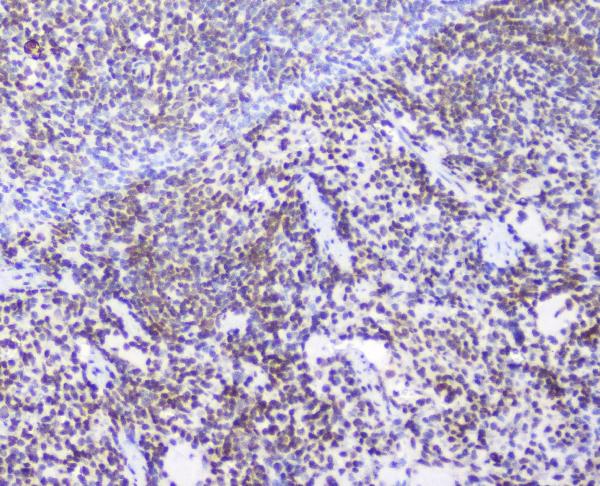 IHC analysis of AHR using anti-AHR antibody (A00225-2). AHR was detected in paraffin-embedded section of rat spleen tissue. Heat mediated antigen retrieval was performed in citrate buffer (pH6, epitope retrieval solution) for 20 mins. The tissue section was blocked with 10% goat serum. The tissue section was then incubated with 2μg/ml rabbit anti-AHR Antibody (A00225-2) overnight at 4°C. Biotinylated goat anti-rabbit IgG was used as secondary antibody and incubated for 30 minutes at 37°C. The tissue section was developed using Strepavidin-Biotin-Complex (SABC)(Catalog # SA1022) with DAB as the chromogen.