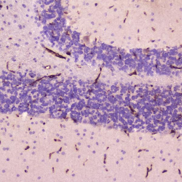 IHC analysis of C Reactive Protein using anti-C Reactive Protein antibody (A00249-2). C Reactive Protein was detected in paraffin-embedded section of rat cerebellum tissue. Heat mediated antigen retrieval was performed in citrate buffer (pH6, epitope retrieval solution) for 20 mins. The tissue section was blocked with 10% goat serum. The tissue section was then incubated with 2μg/ml rabbit anti-C Reactive Protein Antibody (A00249-2) overnight at 4℃. Biotinylated goat anti-rabbit IgG was used as secondary antibody and incubated for 30 minutes at 37℃. The tissue section was developed using Strepavidin-Biotin-Complex (SABC)(Catalog # SA1022) with DAB as the chromogen.