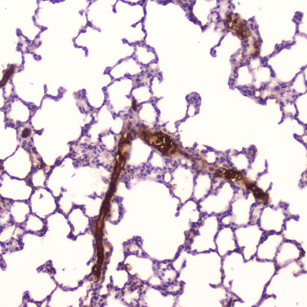 IHC analysis of C Reactive Protein using anti-C Reactive Protein antibody (A00249-2). C Reactive Protein was detected in paraffin-embedded section of rat lung tissue. Heat mediated antigen retrieval was performed in citrate buffer (pH6, epitope retrieval solution) for 20 mins. The tissue section was blocked with 10% goat serum. The tissue section was then incubated with 2μg/ml rabbit anti-C Reactive Protein Antibody (A00249-2) overnight at 4℃. Biotinylated goat anti-rabbit IgG was used as secondary antibody and incubated for 30 minutes at 37℃. The tissue section was developed using Strepavidin-Biotin-Complex (SABC)(Catalog # SA1022) with DAB as the chromogen.