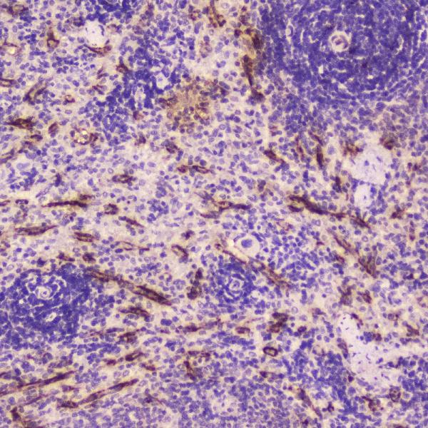 IHC analysis of C Reactive Protein using anti-C Reactive Protein antibody (A00249-2). C Reactive Protein was detected in paraffin-embedded section of rat spleen tissue. Heat mediated antigen retrieval was performed in citrate buffer (pH6, epitope retrieval solution) for 20 mins. The tissue section was blocked with 10% goat serum. The tissue section was then incubated with 2μg/ml rabbit anti-C Reactive Protein Antibody (A00249-2) overnight at 4°C. Biotinylated goat anti-rabbit IgG was used as secondary antibody and incubated for 30 minutes at 37°C. The tissue section was developed using Strepavidin-Biotin-Complex (SABC)(Catalog # SA1022) with DAB as the chromogen.