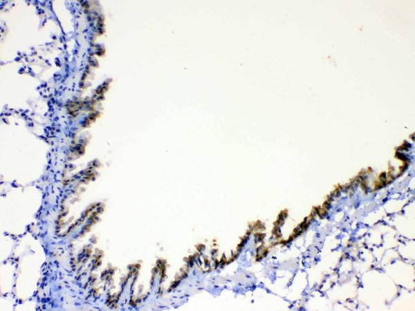 IHC analysis of AGRP using anti-AGRP antibody (A00272-1).