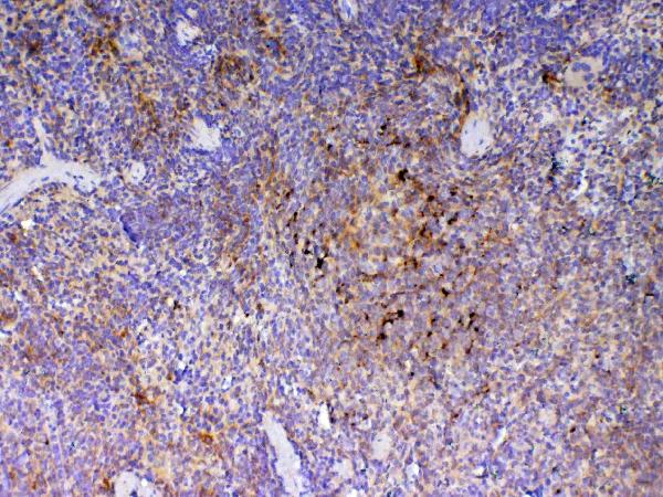 IHC analysis of ICOS using anti-ICOS antibody (A00291-2).