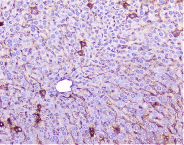 IHC analysis of TNF Receptor I using anti-TNF Receptor I antibody (A00294-3). TNF Receptor I was detected in paraffin-embedded section of mouse liver tissue. Heat mediated antigen retrieval was performed in citrate buffer (pH6, epitope retrieval solution) for 20 mins. The tissue section was blocked with 10% goat serum. The tissue section was then incubated with 1μg/ml rabbit anti-TNF Receptor I Antibody (A00294-3) overnight at 4°C. Biotinylated goat anti-rabbit IgG was used as secondary antibody and incubated for 30 minutes at 37°C. The tissue section was developed using Strepavidin-Biotin-Complex (SABC)(Catalog # SA1022) with DAB as the chromogen.