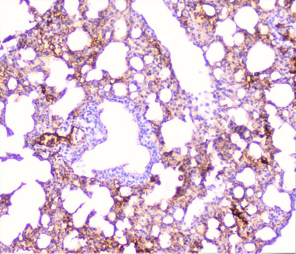 IHC analysis of TNF Receptor I using anti-TNF Receptor I antibody (A00294-3). TNF Receptor I was detected in paraffin-embedded section of mouse lung tissue. Heat mediated antigen retrieval was performed in citrate buffer (pH6, epitope retrieval solution) for 20 mins. The tissue section was blocked with 10% goat serum. The tissue section was then incubated with 1μg/ml rabbit anti-TNF Receptor I Antibody (A00294-3) overnight at 4°C. Biotinylated goat anti-rabbit IgG was used as secondary antibody and incubated for 30 minutes at 37°C. The tissue section was developed using Strepavidin-Biotin-Complex (SABC)(Catalog # SA1022) with DAB as the chromogen.