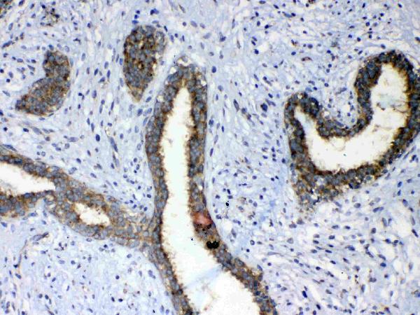 IHC analysis of ErbB 4 using anti-ErbB 4 antibody (A00296).