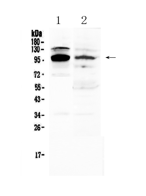 Western blot analysis of NFAT2 using anti-NFAT2 antibody (A00340-1). Electrophoresis was performed on a 5-20% SDS-PAGE gel at 70V (Stacking gel) / 90V (Resolving gel) for 2-3 hours. The sample well of each lane was loaded with 50ug of sample under reducing conditions. Lane 1: mouse thymus tissue lysates, Lane 2: human 22RV1 whole cell lysates. After Electrophoresis, proteins were transferred to a Nitrocellulose membrane at 150mA for 50-90 minutes. Blocked the membrane with 5% Non-fat Milk/ TBS for 1.5 hour at RT. The membrane was incubated with rabbit anti-NFAT2 antigen affinity purified polyclonal antibody (Catalog # A00340-1) at 0.5 ug/mL overnight at 4 then washed with TBS-0.1%Tween 3 times with 5 minutes each and probed with a goat anti-rabbit IgG-HRP secondary antibody at a dilution of 1:10000 for 1.5 hour at RT. The signal is developed using an Enhanced Chemiluminescent detection (ECL) kit (Catalog # EK1002) with Tanon 5200 system. A specific band was detected for NFAT2 at approximately 101KD. The expected band size for NFAT2 is at 101KD.