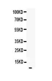 Western blot analysis of EGF using anti-EGF antibody (A00378-1).