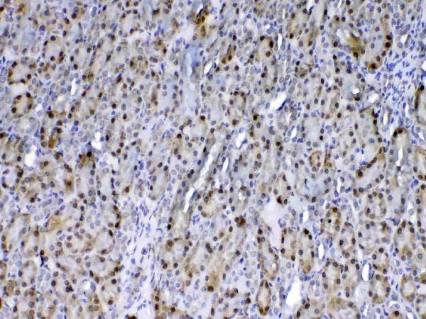 IHC analysis of GST3 / GST pi using anti-GST3 / GST pi antibody (A00394-1). GST3 / GST pi was detected in paraffin-embedded section of rat kidney tissue. Heat mediated antigen retrieval was performed in citrate buffer (pH6, epitope retrieval solution) for 20 mins. The tissue section was blocked with 10% goat serum. The tissue section was then incubated with 1ug/ml rabbit anti-GST3 / GST pi Antibody (A00394-1) overnight at 4 Biotinylated goat anti-rabbit IgG was used as secondary antibody and incubated for 30 minutes at 37 The tissue section was developed using Strepavidin-Biotin-Complex (SABC)(Catalog # SA1022) with DAB as the chromogen.