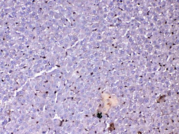 IHC analysis of GST3 / GST pi using anti-GST3 / GST pi antibody (A00394-1). GST3 / GST pi was detected in paraffin-embedded section of rat liver tissue. Heat mediated antigen retrieval was performed in citrate buffer (pH6, epitope retrieval solution) for 20 mins. The tissue section was blocked with 10% goat serum. The tissue section was then incubated with 1ug/ml rabbit anti-GST3 / GST pi Antibody (A00394-1) overnight at 4 Biotinylated goat anti-rabbit IgG was used as secondary antibody and incubated for 30 minutes at 37 The tissue section was developed using Strepavidin-Biotin-Complex (SABC)(Catalog # SA1022) with DAB as the chromogen.