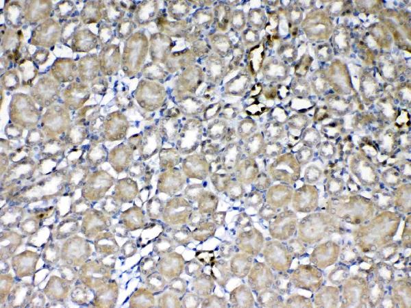 IHC analysis of GST3 / GST pi using anti-GST3 / GST pi antibody (A00394). GST3 / GST pi was detected in paraffin-embedded section of mouse kidney tissue. Heat mediated antigen retrieval was performed in citrate buffer (pH6, epitope retrieval solution) for 20 mins. The tissue section was blocked with 10% goat serum. The tissue section was then incubated with 1ug/ml rabbit anti-GST3 / GST pi Antibody (A00394) overnight at 4 Biotinylated goat anti-rabbit IgG was used as secondary antibody and incubated for 30 minutes at 37 The tissue section was developed using Strepavidin-Biotin-Complex (SABC)(Catalog # SA1022) with DAB as the chromogen.