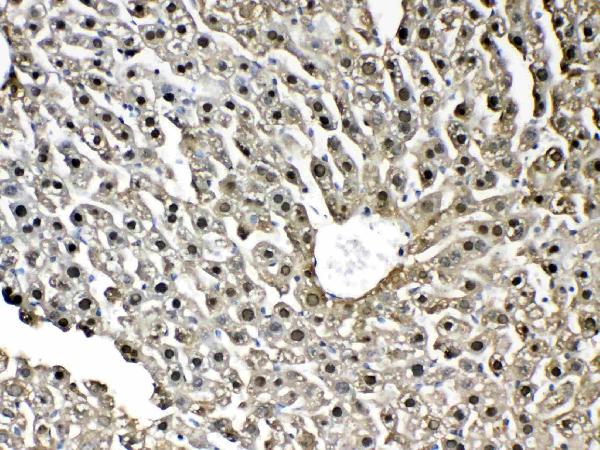 IHC analysis of GST3 / GST pi using anti-GST3 / GST pi antibody (A00394). GST3 / GST pi was detected in paraffin-embedded section of mouse liver tissue. Heat mediated antigen retrieval was performed in citrate buffer (pH6, epitope retrieval solution) for 20 mins. The tissue section was blocked with 10% goat serum. The tissue section was then incubated with 1ug/ml rabbit anti-GST3 / GST pi Antibody (A00394) overnight at 4 Biotinylated goat anti-rabbit IgG was used as secondary antibody and incubated for 30 minutes at 37 The tissue section was developed using Strepavidin-Biotin-Complex (SABC)(Catalog # SA1022) with DAB as the chromogen.