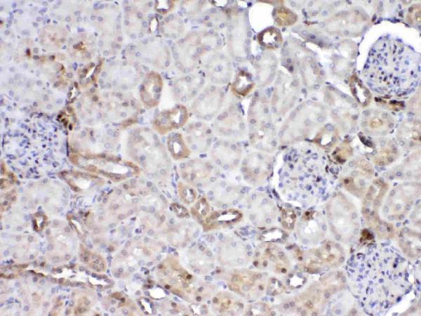 IHC analysis of GST3 / GST pi using anti-GST3 / GST pi antibody (A00394). GST3 / GST pi was detected in paraffin-embedded section of rat kidney tissue. Heat mediated antigen retrieval was performed in citrate buffer (pH6, epitope retrieval solution) for 20 mins. The tissue section was blocked with 10% goat serum. The tissue section was then incubated with 1ug/ml rabbit anti-GST3 / GST pi Antibody (A00394) overnight at 4 Biotinylated goat anti-rabbit IgG was used as secondary antibody and incubated for 30 minutes at 37 The tissue section was developed using Strepavidin-Biotin-Complex (SABC)(Catalog # SA1022) with DAB as the chromogen.