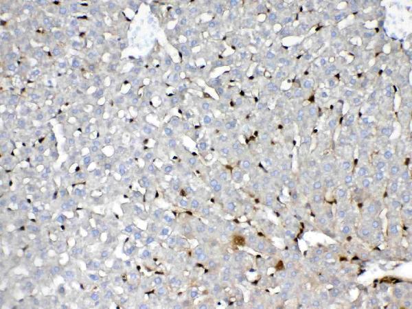 IHC analysis of GST3 / GST pi using anti-GST3 / GST pi antibody (A00394). GST3 / GST pi was detected in paraffin-embedded section of rat liver tissue. Heat mediated antigen retrieval was performed in citrate buffer (pH6, epitope retrieval solution) for 20 mins. The tissue section was blocked with 10% goat serum. The tissue section was then incubated with 1ug/ml rabbit anti-GST3 / GST pi Antibody (A00394) overnight at 4 Biotinylated goat anti-rabbit IgG was used as secondary antibody and incubated for 30 minutes at 37 The tissue section was developed using Strepavidin-Biotin-Complex (SABC)(Catalog # SA1022) with DAB as the chromogen.