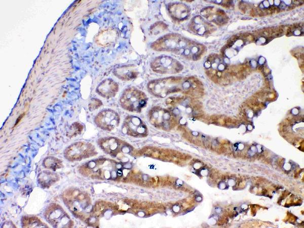 IHC analysis of MMP13 using anti-MMP13 antibody (A00420-2).