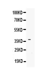 Western blot analysis of IGFBP3 using anti-IGFBP3 antibody (A00435-2). Electrophoresis was performed on a 5-20% SDS-PAGE gel at 70V (Stacking gel) / 90V (Resolving gel) for 2-3 hours. Lane 1: recombinant human IGFBP3 protein 1ng. After Electrophoresis, proteins were transferred to a Nitrocellulose membrane at 150mA for 50-90 minutes. Blocked the membrane with 5% Non-fat Milk/ TBS for 1.5 hour at RT. The membrane was incubated with rabbit anti-IGFBP3 antigen affinity purified polyclonal antibody (Catalog # A00435-2) at 0.5 ug/mL overnight at 4 then washed with TBS-0.1%Tween 3 times with 5 minutes each and probed with a goat anti-rabbit IgG-HRP secondary antibody at a dilution of 1:10000 for 1.5 hour at RT. The signal is developed using an Enhanced Chemiluminescent detection (ECL) kit (Catalog # EK1002) with Tanon 5200 system. A specific band was detected for IGFBP3 at approximately 37KD. The expected band size for IGFBP3 is at 29KD.