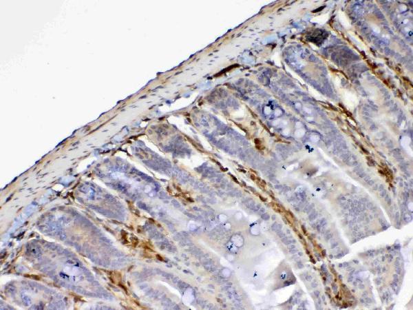 IHC analysis of Galectin 1 using anti-Galectin 1 antibody (A00470-1). Galectin 1 was detected in paraffin-embedded section of mouse small intestine tissue. Heat mediated antigen retrieval was performed in citrate buffer (pH6, epitope retrieval solution) for 20 mins. The tissue section was blocked with 10% goat serum. The tissue section was then incubated with 1ug/ml rabbit anti-Galectin 1 Antibody (A00470-1) overnight at 4 Biotinylated goat anti-rabbit IgG was used as secondary antibody and incubated for 30 minutes at 37 The tissue section was developed using Strepavidin-Biotin-Complex (SABC)(Catalog # SA1022) with DAB as the chromogen.