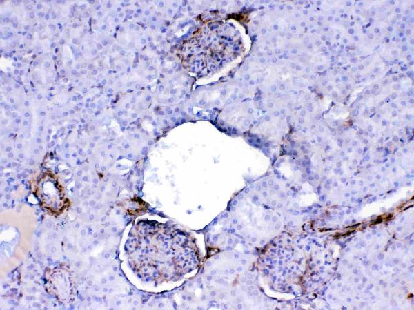 IHC analysis of Galectin 1 using anti-Galectin 1 antibody (A00470-1). Galectin 1 was detected in paraffin-embedded section of rat kidney tissue. Heat mediated antigen retrieval was performed in citrate buffer (pH6, epitope retrieval solution) for 20 mins. The tissue section was blocked with 10% goat serum. The tissue section was then incubated with 1ug/ml rabbit anti-Galectin 1 Antibody (A00470-1) overnight at 4 Biotinylated goat anti-rabbit IgG was used as secondary antibody and incubated for 30 minutes at 37 The tissue section was developed using Strepavidin-Biotin-Complex (SABC)(Catalog # SA1022) with DAB as the chromogen.