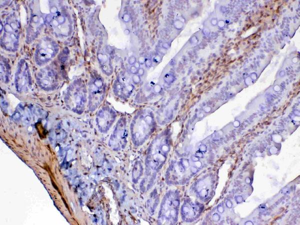 IHC analysis of Galectin 1 using anti-Galectin 1 antibody (A00470-1). Galectin 1 was detected in paraffin-embedded section of rat small intestine tissue. Heat mediated antigen retrieval was performed in citrate buffer (pH6, epitope retrieval solution) for 20 mins. The tissue section was blocked with 10% goat serum. The tissue section was then incubated with 1ug/ml rabbit anti-Galectin 1 Antibody (A00470-1) overnight at 4 Biotinylated goat anti-rabbit IgG was used as secondary antibody and incubated for 30 minutes at 37 The tissue section was developed using Strepavidin-Biotin-Complex (SABC)(Catalog # SA1022) with DAB as the chromogen.